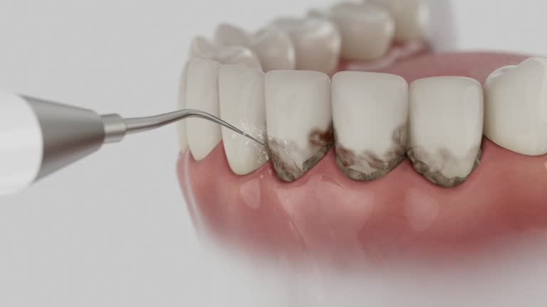 Trusted Invisalign Clear Aligners service in Wyoming, IL - Dentist Open Now